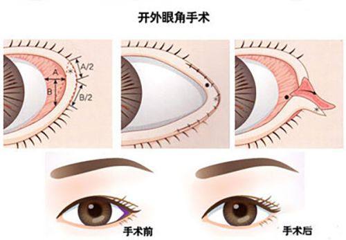 三、相关医美操作的间隔参考（纹眼线、面部护理、化妆）