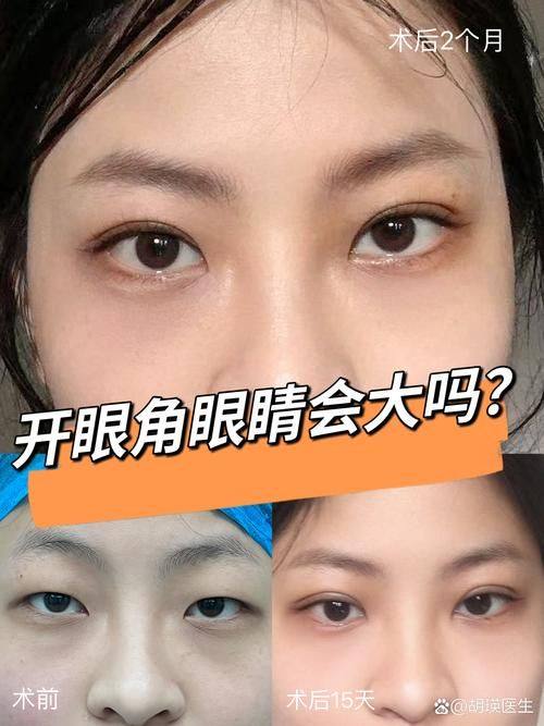 沧州静港整形医疗美容医院擅长项目：