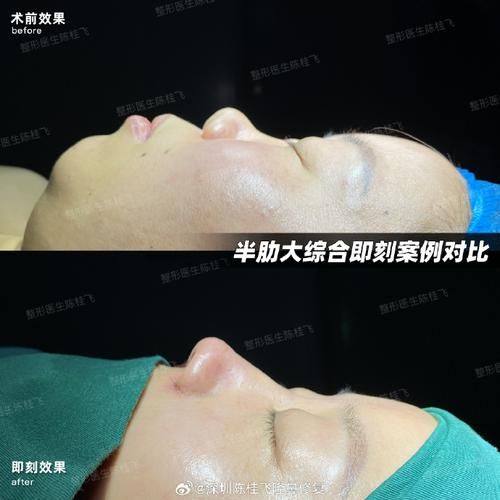 枣庄胡乐祥医疗美容口碑评价：