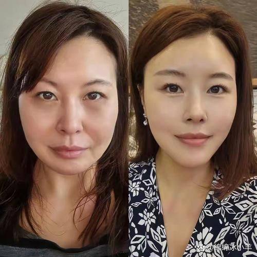 严友才医生口碑评价