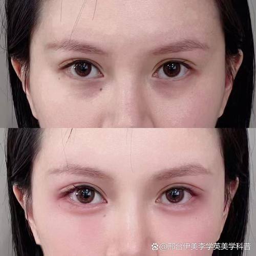 长沙花榕悦貌整形医院擅长项目：