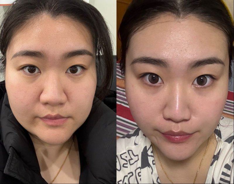 长沙花榕悦貌整形医院怎么样？