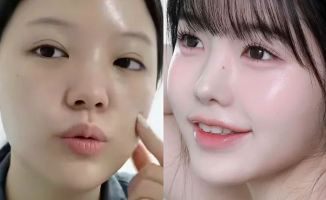 三、打完瘦脸针多久可以趴着按摩