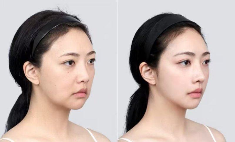 长沙花榕悦貌整形医院地址电话及营业时间：