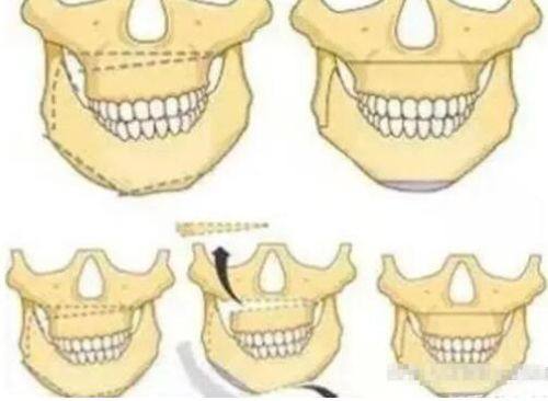 六、老年群体的额外专属风险