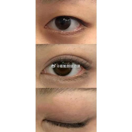 北京善方医院医学美容中 心预约挂号方式：