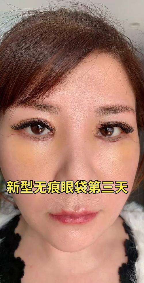 菏泽佳慕医疗美容门诊部口碑评价：