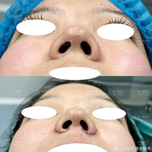 新疆华美整形美容医院如何价格表: