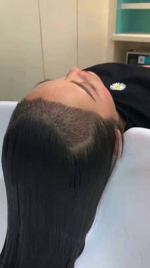 菏泽佳慕医疗美容门诊部价格表：