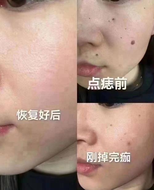 菏泽佳慕医疗美容门诊部擅长项目：