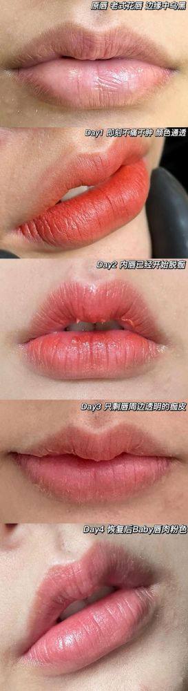 新疆华美整形美容医院如何怎么样?