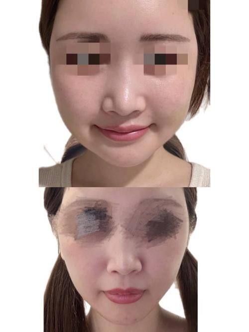 石家庄市新华区汉芳东购医疗美容诊所预约挂号方式