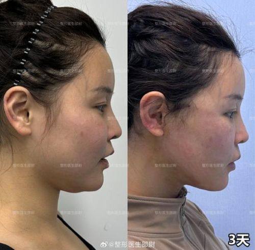 金陵嘉怡美医疗美容医院价格表