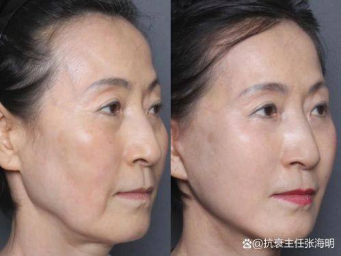 北京善方医院医学美容中 心擅长项目：