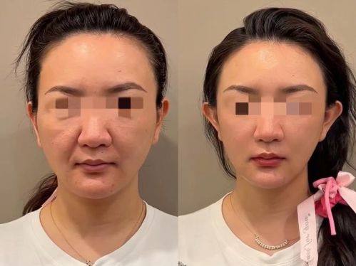 金陵嘉怡美医疗美容医院擅长项目