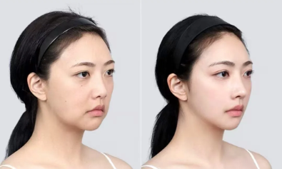 松原齐飞美容外科门诊部擅长项目