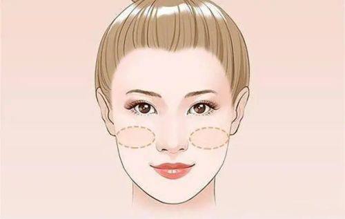 三、脸上激光祛疤的收费参考