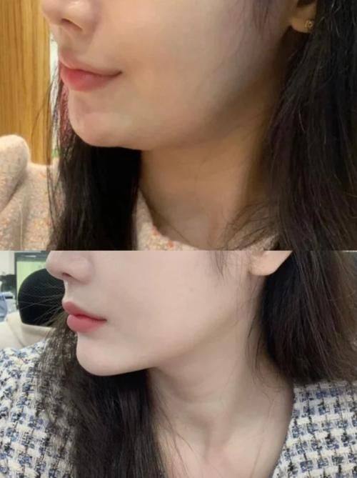 固原市田惠英医疗美容诊所怎么样？