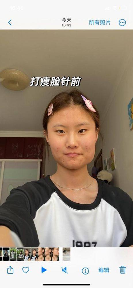 固原市田惠英医疗美容诊所医生名单及擅长领域：