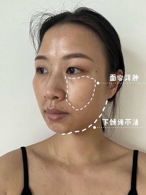 固原市田惠英医疗美容诊所擅长项目：