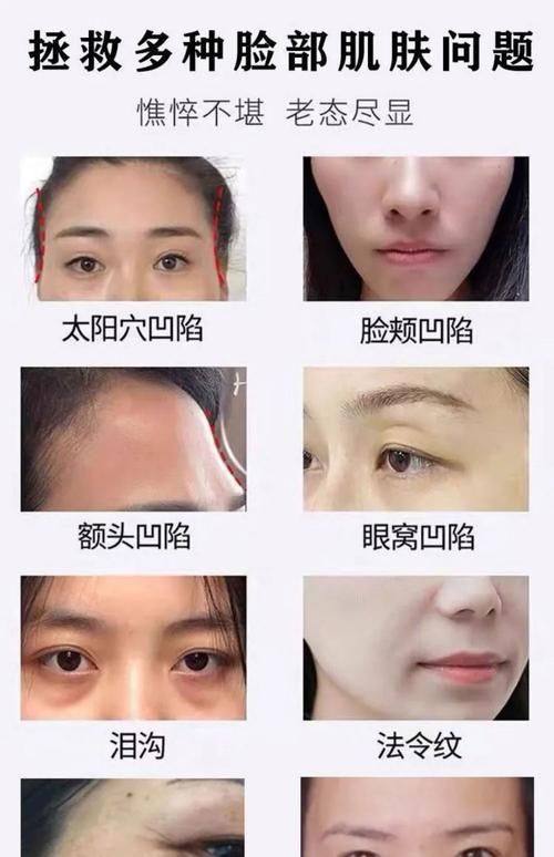 温州医学校附属瑞安市人民医院烧伤整形科地址电话及营业时间