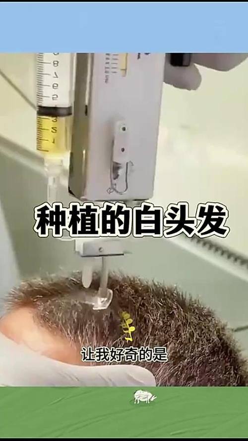 北京中德毛发移植整形医院有限公司地址电话及营业时间：