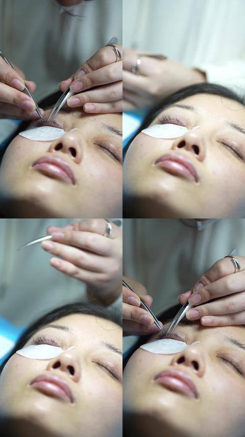 北京中德毛发移植整形医院有限公司医生名单及擅长领域：