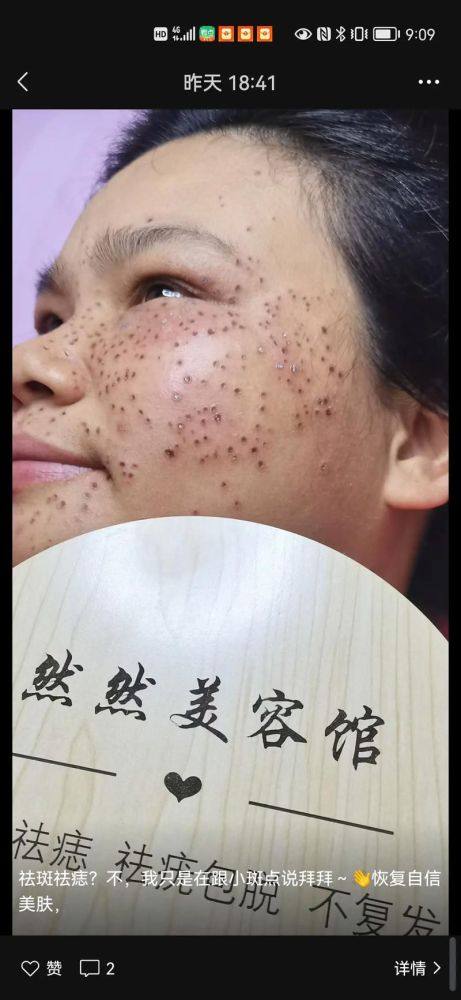 谢诗思医生技术优势