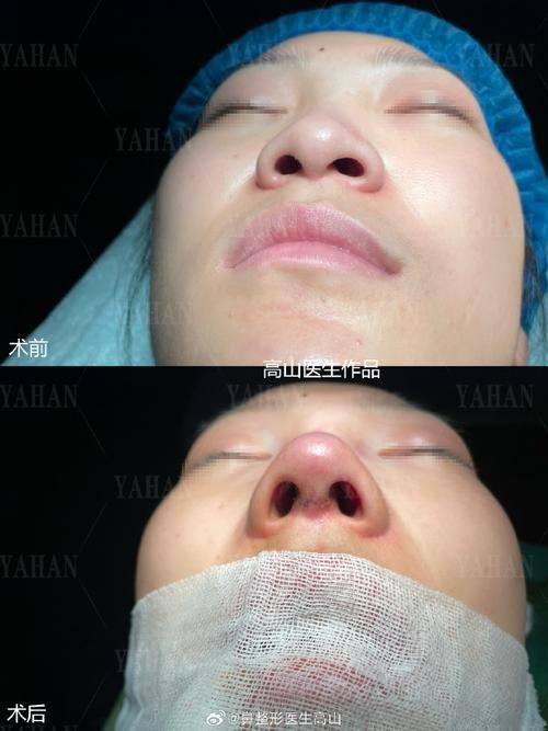 济南江南整形医院价格表