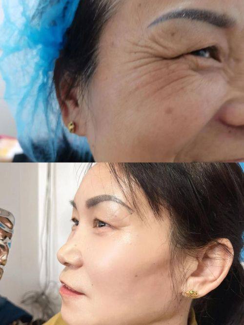 邢台伊美医疗美容诊所医生名单及擅长领域