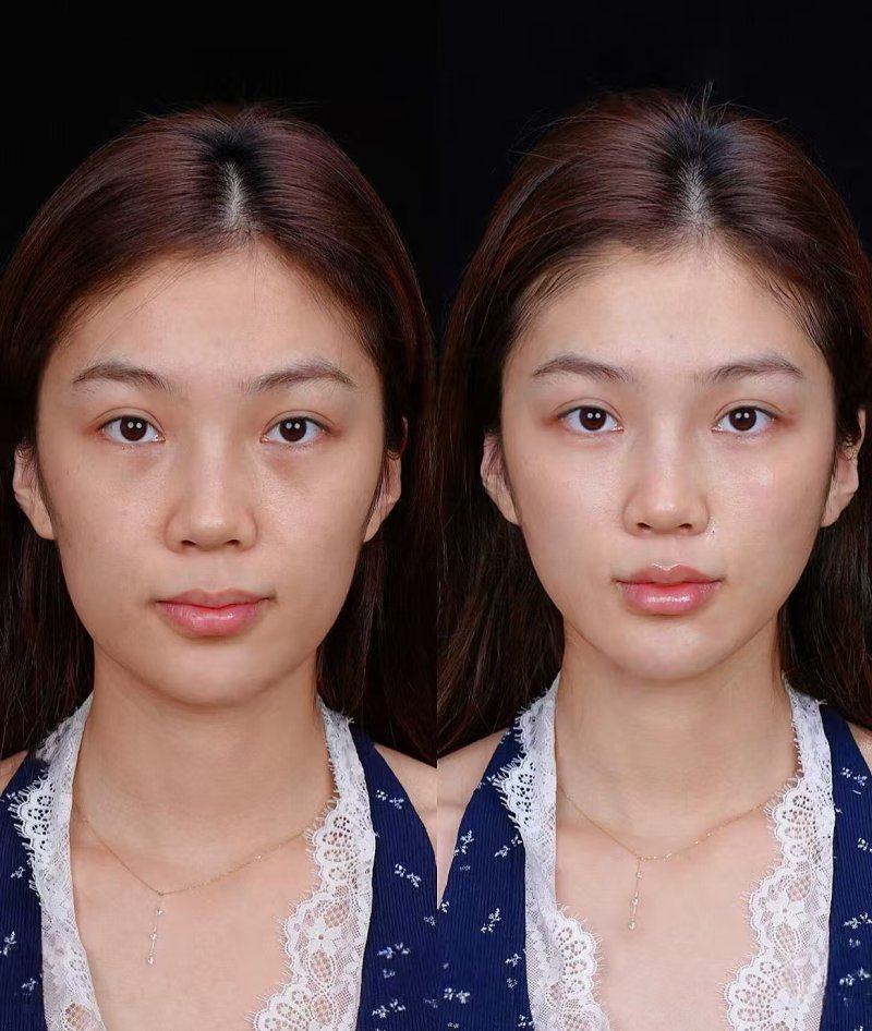 四、儿童下眼袋常年发黑怎么调理：天然安心的外用护理方法