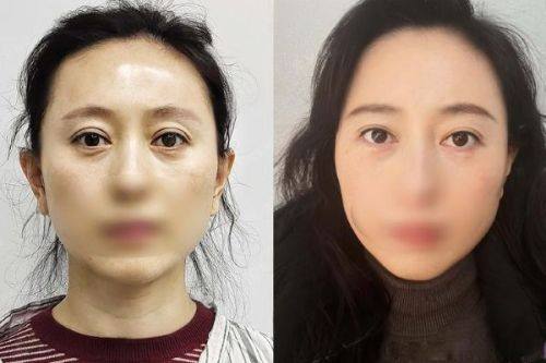 包涛医生怎么预约