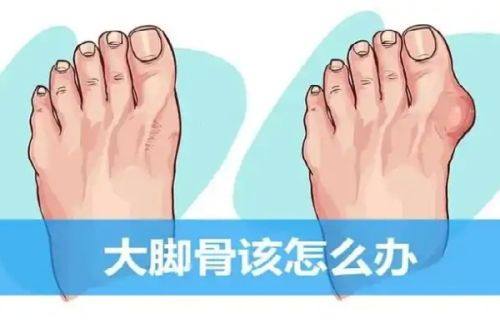 三、如何有效抑制轻度疤痕增生