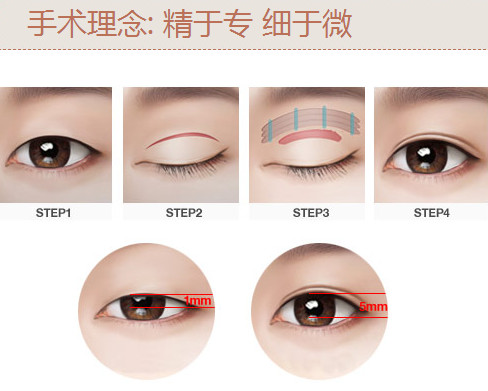 四、儿童面部祛疤的核心注意事项