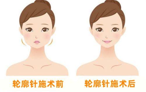 三、儿童面部祛疤的居家辅助护理妙招