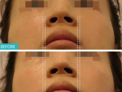 宜宾天使之翼整形医院价格表：