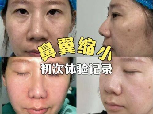 宜宾天使之翼整形医院口碑评价：