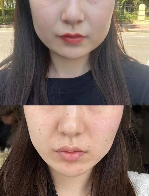 昆明虹丽医学美容整形医院地址电话及营业时间：