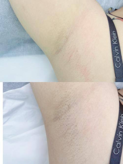 韩煜华医生技术优势