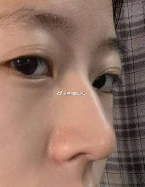 岳阳乔雅零贰医疗美容门诊部擅长项目