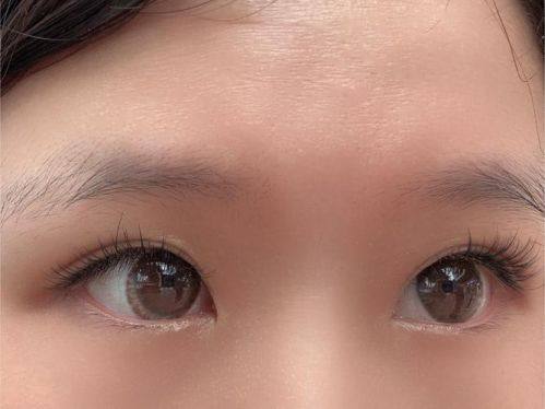 深圳美客华美医疗美容门诊部口碑评价：