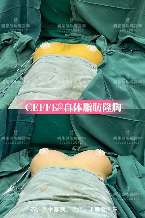 深圳美客华美医疗美容门诊部预约挂号方式：