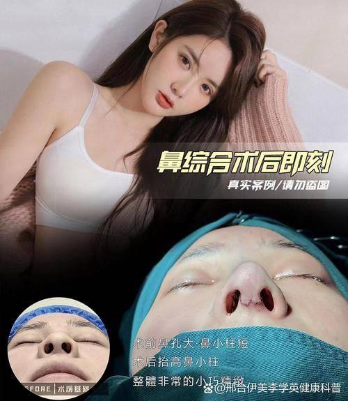 宜宾天使之翼整形医院擅长项目：