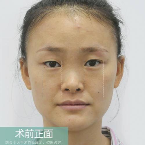 上海医颜整形医疗美容医院怎么样？