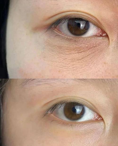 昆明虹丽医学美容整形医院口碑评价：