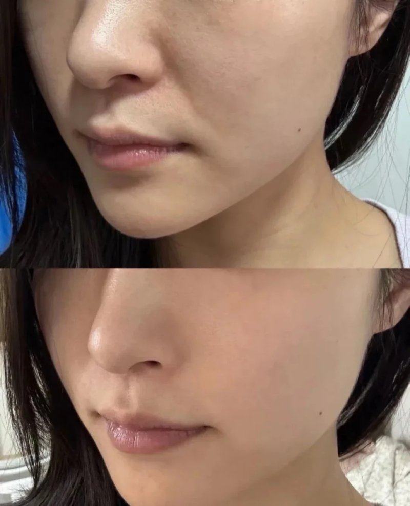 三门峡维蜜医疗美容诊所擅长项目