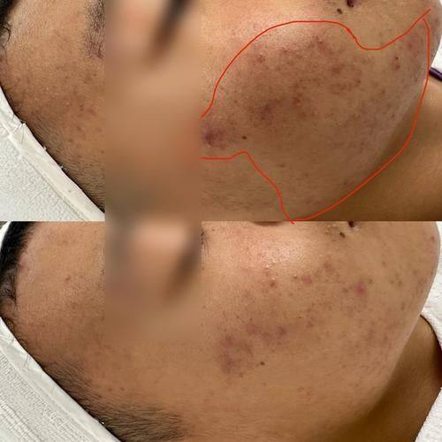 湖南凯思丽医疗美容擅长项目：