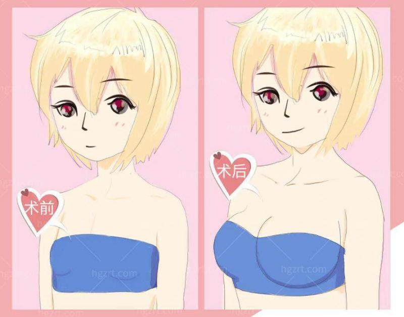 欧阳春坐诊广州中家医家庭医生医疗美容门诊部：3D模拟设计流程全解析