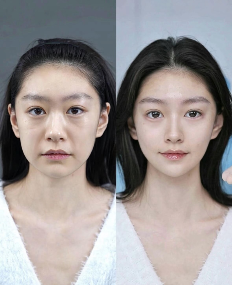 陈凌燕医生怎么预约