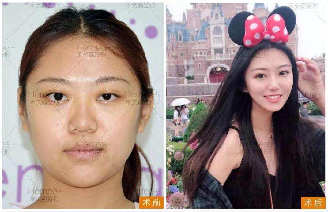 北京禾美嘉医疗美容门诊部李梦莹好预约吗？3种专属预约途径全解析